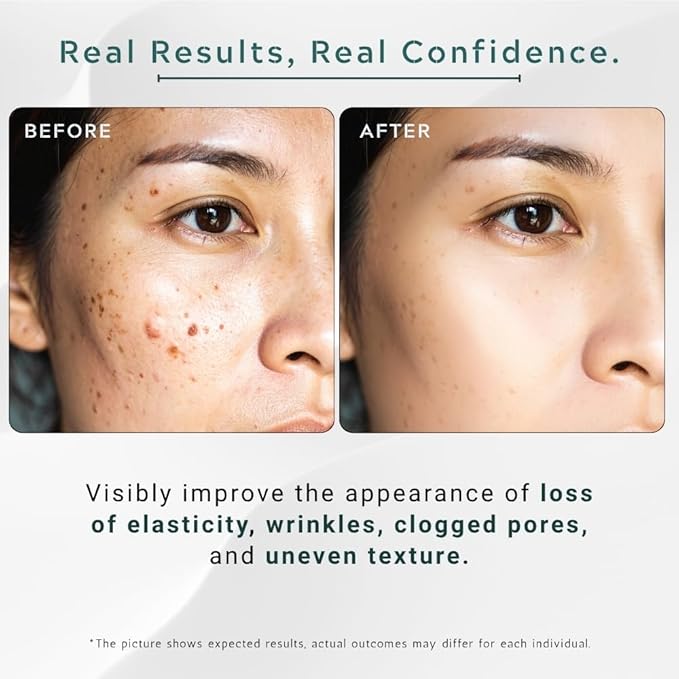Squalane 5% + Hyaluronic Acid 2% + Vitamin E – Advanced Hydrating & Anti-Aging Face Serum – Restores Elasticity, Smooths Fine Lines – Lightweight Moisture for All Skin Types – 1 fl oz