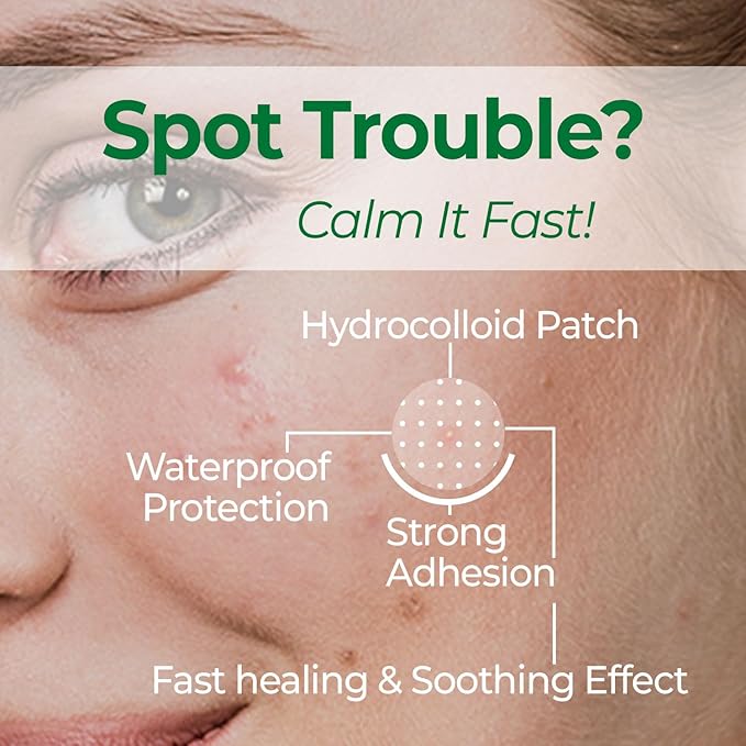 Medifordear Spotty Calming Patches with Cica and Heartleaf Extract Acne Patch Treatment for Breakouts, Absorbs Zits & Blemish, Korean Skin Care, 2 Sizes 12mm x 42 Patches, 10 mm x 63 Patches