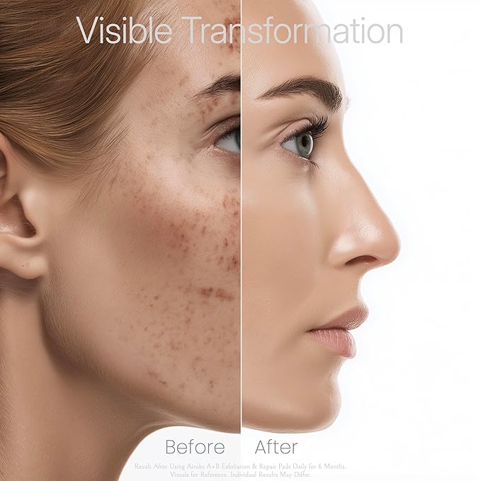 A+B Exfoliating & Repair Face Pads 10 Tx - 2-Step Acid Peel Serum Treatment with Glycolic, Salicylic, Kojic Acid & Retinol Hyaluronic Peptides for Smooth Skin, Pore Minimizer, Hyperpigmentation
