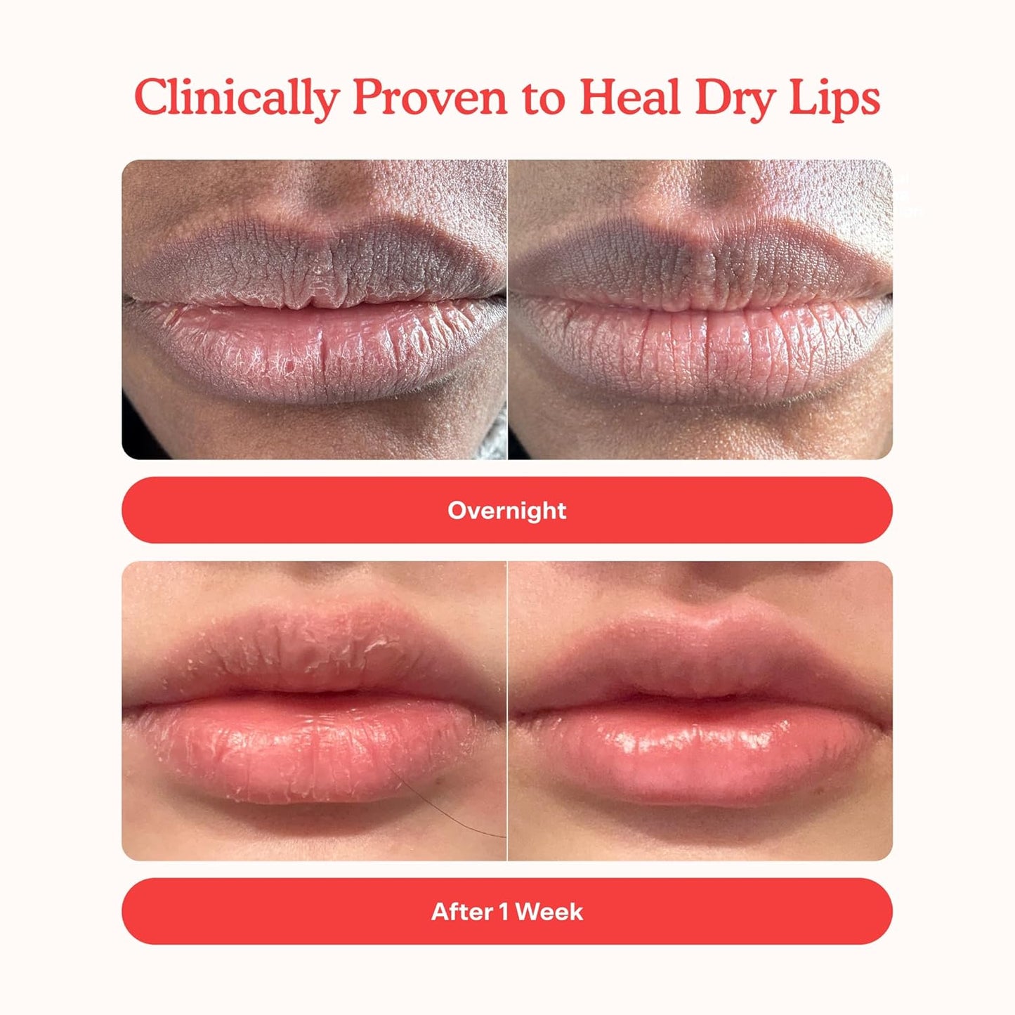 Tower 28 LipSoftie Hydrating Tinted Lip Treatment Balm, Moisturizing Lip Mask for Chapped Lips - Confetti Cake, Sheer Lavender Pink
