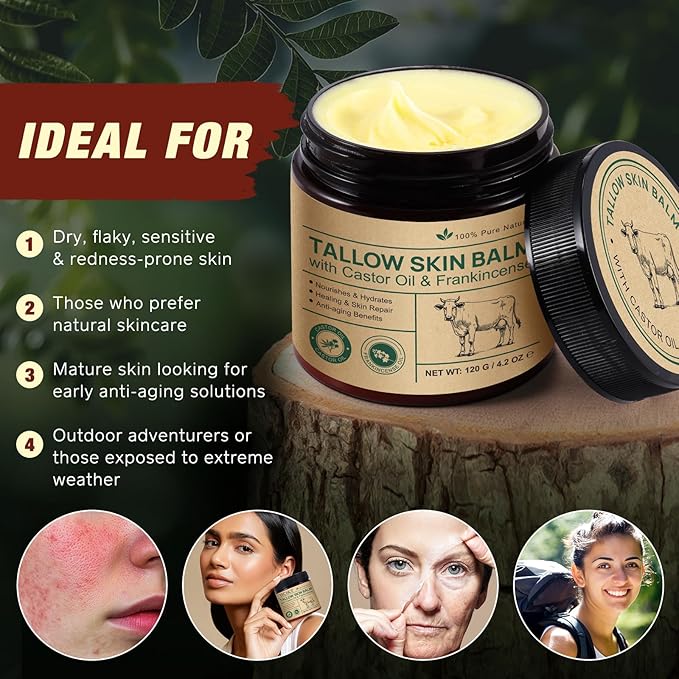 Tallow Castor Frankincense Oil Cream, 2 Pack Beef Tallow for Skin Care with Castor & Frankincense Oil Balm, Moisturising Cream for Face & Body for Sensitive and Dry Skin, Deeply Hydrating Anti-aging