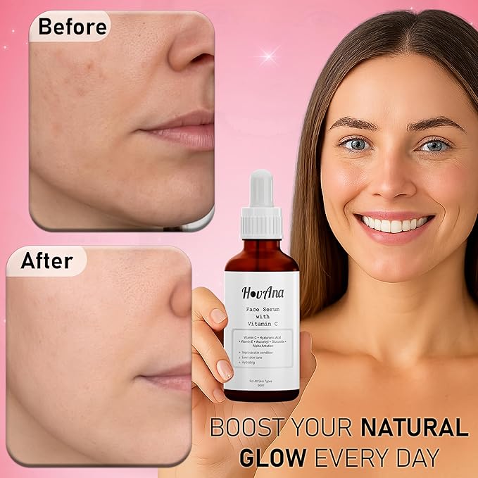 Vitamin C Serum for Face – Brightening, Dark Spot Corrector with Hyaluronic Acid & Vitamin E, Anti-Aging, Glowing Skin Facial Serum, 50ml